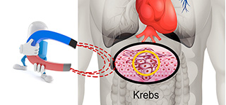 Nanopartikel als Magnetische Drug Targeting gegen Tumor