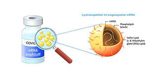 Lipidnanopartikel als Vehikel für mRNA-Impfstoffe